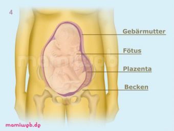 Die Beckenendlage (BEL) im Mutterleib