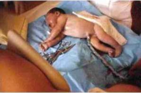 Lia direkt nach der Geburt geburtsbericht-baby