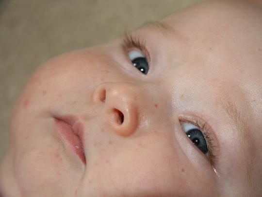 Allergien vorbeugen baby