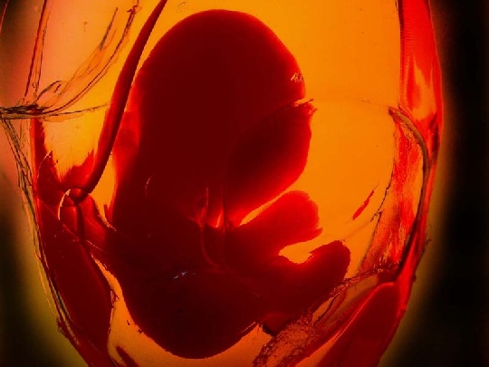 Baby´s Entwicklung soll ungestört sein angelsound
