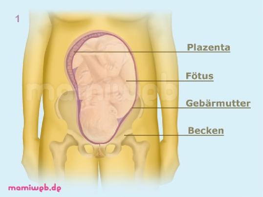 Schädelllage: Sternengucker schaedelllage-sternengucker
