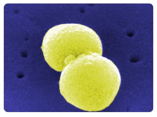 Pneumokokken: Gefährlich für Säuglinge pneumokokken