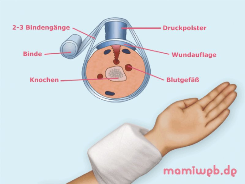Dass man die Schwangere von der Hämorrhoide machen kann
