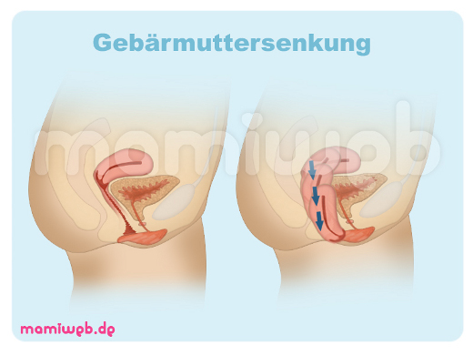 weibliche vagina bilder nach der geburt