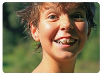 KidsDocs - keine Angst mehr vor dem Zahnarzt