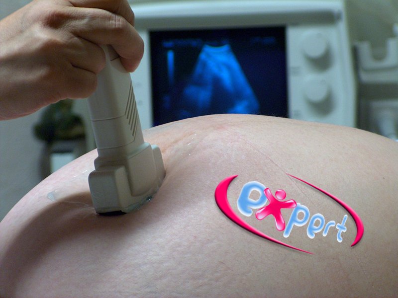 Kriege ich ein großes Baby? ultraschall-baby