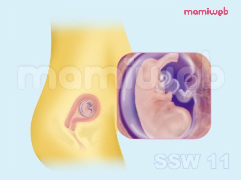 11 Schwangerschaftswoche 11 Ssw Mamiweb De