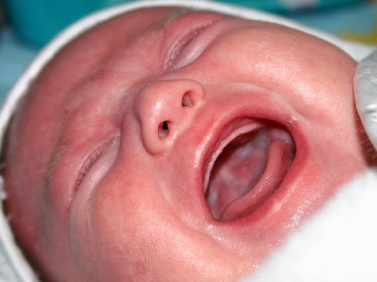 Mamaaaaa! schreiendes-baby