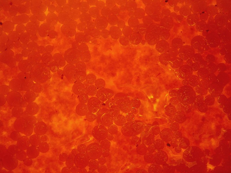 Endometriose endometriose