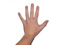 Taubheitsgefühl in der Hand