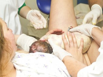 Aus der scheide geburt baby